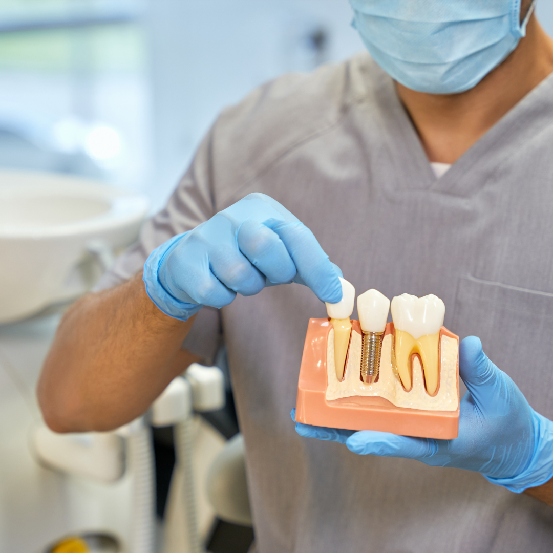 Implantes e Próteses